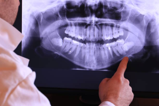 Best Emergency Dental Care for Broken or Chipped Teeth in Forestde, AL